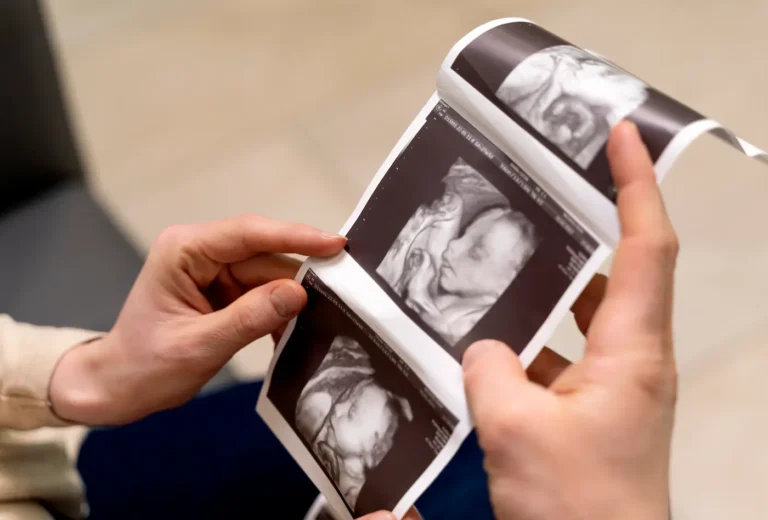 frozen embryo transfer timeline